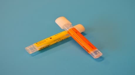Can Cannabis Be Detected In Urine?